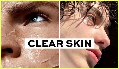 Do models need to have clear skin?